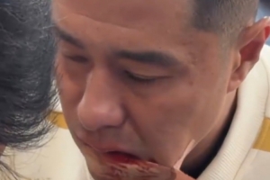 硬漢！國安足協(xié)杯奪冠后，侯森在場邊默默處理嘴部傷口